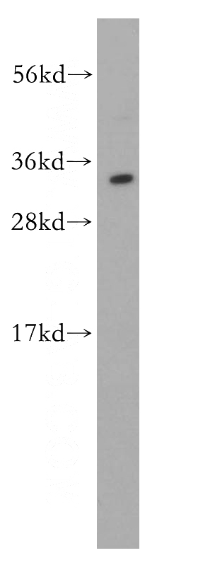 Jurkat cells were subjected to SDS PAGE followed by western blot with Catalog No:111479(HMGB2 antibody) at dilution of 1:600