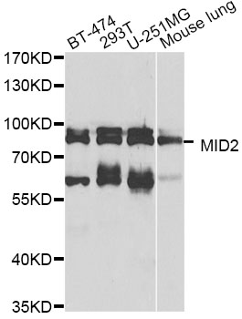 Western blot - MID2 Polyclonal Antibody 