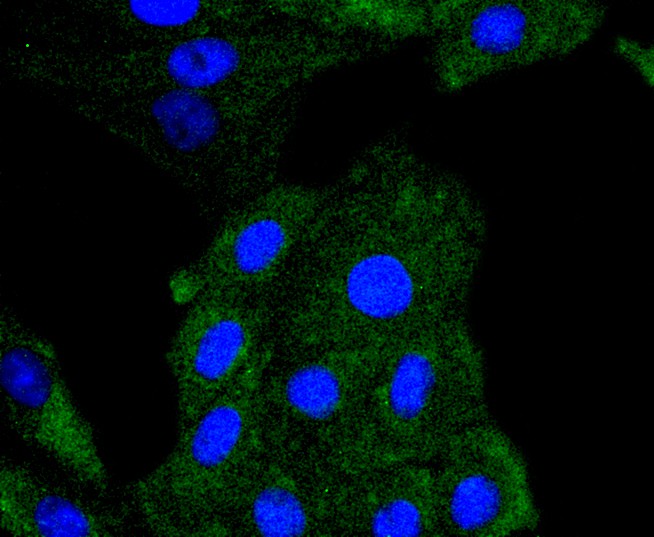 Fig3: ICC staining PDGF Receptor beta(phospho Y740) in L6 cells (green). The nuclear counter stain is DAPI (blue). Cells were fixed in paraformaldehyde, permeabilised with 0.25% Triton X100/PBS.