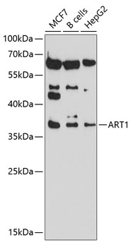 Western blot - ART1 Polyclonal Antibody 