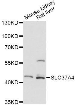 Western blot - SLC37A4 Polyclonal Antibody 
