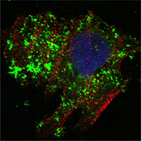 Confocal immunofluorescence analysis of Hela cells using BCL10 mouse mAb (green). Red: Actin filaments have been labeled with Alexa Fluor-555 phalloidin. Blue: DRAQ5 fluorescent DNA dye.