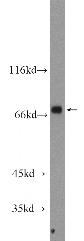 NIH/3T3 cells were subjected to SDS PAGE followed by western blot with Catalog No:108189(ARHGEF7 Antibody) at dilution of 1:1000