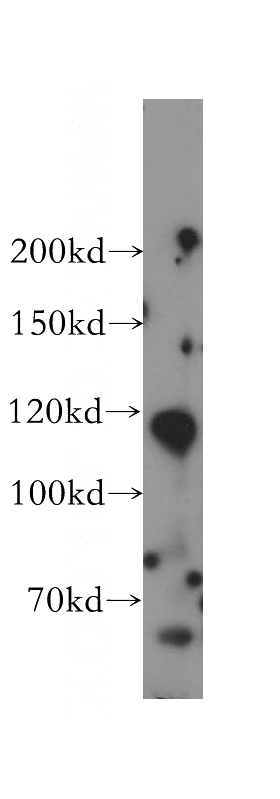 mouse testis tissue were subjected to SDS PAGE followed by western blot with Catalog No:114023(PMFBP1 antibody) at dilution of 1:500