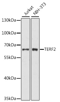 Western blot - TERF2 Polyclonal Antibody 