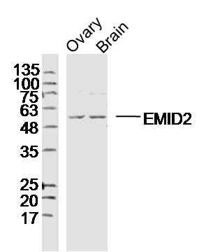 Fig1: Sample:; Ovary (mouse)cell Lysate at 40 ug; Brain (mouse)cell Lysate at 40 ug; Primary: Anti-EMID2 at 1/300 dilution; Secondary: IRDye800CW Goat Anti-RabbitIgG at 1/20000 dilution; Predicted band size: 45 kD; Observed band size: 55 kD
