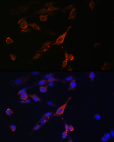 Immunofluorescence - RAB21 Polyclonal Antibody 