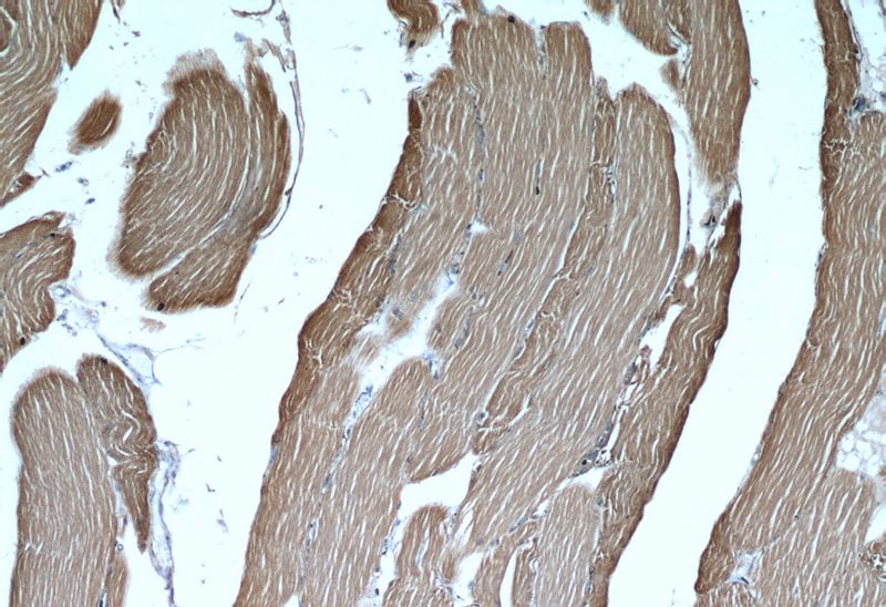 Immunohistochemical of paraffin-embedded human skeletal muscle using Catalog No:107976(ALDOA antibody) at dilution of 1:50 (under 10x lens)