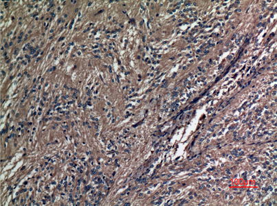 Immunohistochemical analysis of paraffin-embedded human-ovary, antibody was diluted at 1:100