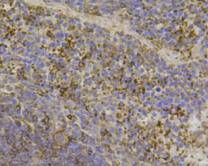 Fig5: Immunohistochemical analysis of paraffin- embedded mouse spleen tissue using anti-CCL3 rabbit polyclonal antibody.