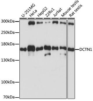 Western blot - DCTN1 Polyclonal Antibody 
