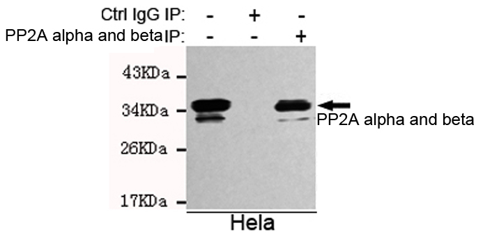 Immunoprecipitation analysis of Hela cell lysates using PP2A alpha and beta mouse mAb.