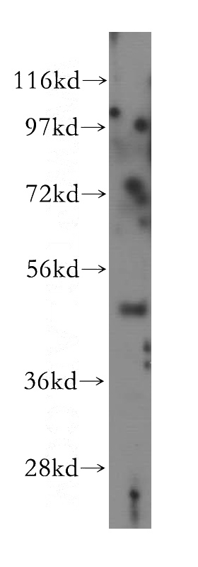 human cerebellum tissue were subjected to SDS PAGE followed by western blot with Catalog No:112971(MYLIP antibody) at dilution of 1:400