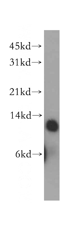 Raji cells were subjected to SDS PAGE followed by western blot with Catalog No:116422(TRX2,TXN2 antibody) at dilution of 1:500