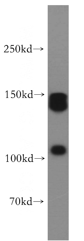 mouse liver tissue were subjected to SDS PAGE followed by western blot with Catalog No:116984(XDH antibody) at dilution of 1:800
