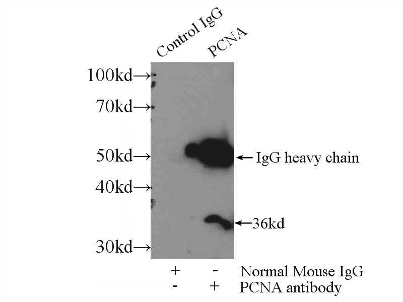 IP Result of anti-PCNA (IP:Catalog No:117335, 4ug; Detection:Catalog No:117335 1:300) with HepG2 cells lysate 3000ug.