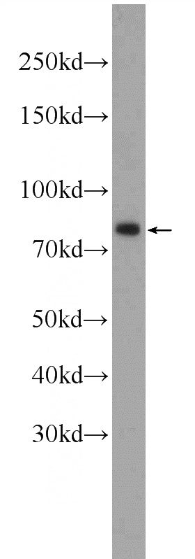K-562 cells were subjected to SDS PAGE followed by western blot with Catalog No:115525(SP2 Antibody) at dilution of 1:300