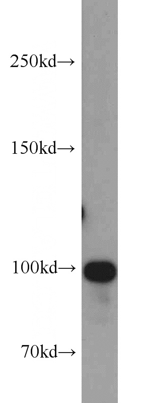 Jurkat cells were subjected to SDS PAGE followed by western blot with Catalog No:113518(OTUD7B antibody) at dilution of 1:800