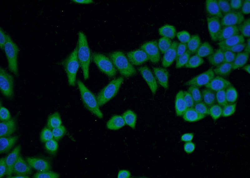Immunofluorescent analysis of HeLa cells using Catalog No:107767(ADAM5P Antibody) at dilution of 1:50 and Alexa Fluor 488-congugated AffiniPure Goat Anti-Rabbit IgG(H+L)