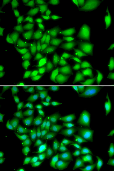 Immunofluorescence - TREX1 Polyclonal Antibody 