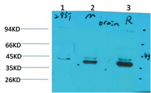 Fig1:; Western blot analysis of 1)293T, 2)Mouse Brain Tissue, 3) Rat Brain Tissue with CABP2 Rabbit pAb diluted at 1:2,000.