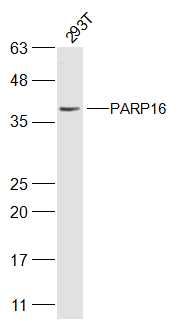 Fig1: Sample:; 293T(Human) Cell Lysate at 30 ug; Primary: Anti-PARP16 at 1/500 dilution; Secondary: IRDye800CW Goat Anti-Rabbit IgG at 1/20000 dilution; Predicted band size: 36 kD; Observed band size: 36 kD