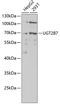 Western blot - UGT2B7 Polyclonal Antibody 