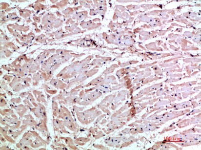 Fig1:; Immunohistochemical analysis of paraffin-embedded human-heart, antibody was diluted at 1:200