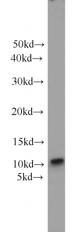 HeLa cells were subjected to SDS PAGE followed by western blot with Catalog No:107601(SRP9 antibody) at dilution of 1:500