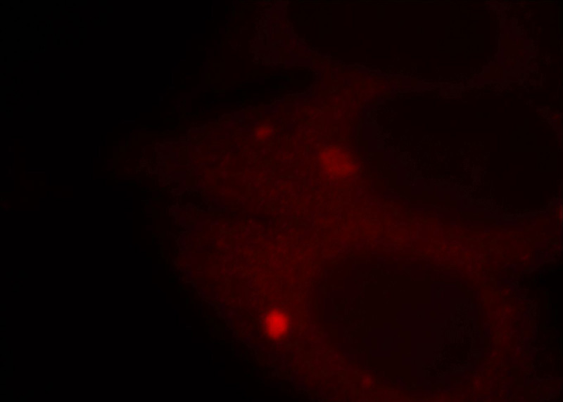 Immunofluorescent analysis of HepG2 cells, using APPL1 antibody Catalog No:108041 at 1:25 dilution and Rhodamine-labeled goat anti-rabbit IgG (red).