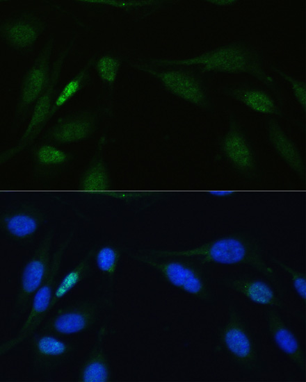 Immunofluorescence - LIG4 Polyclonal Antibody 