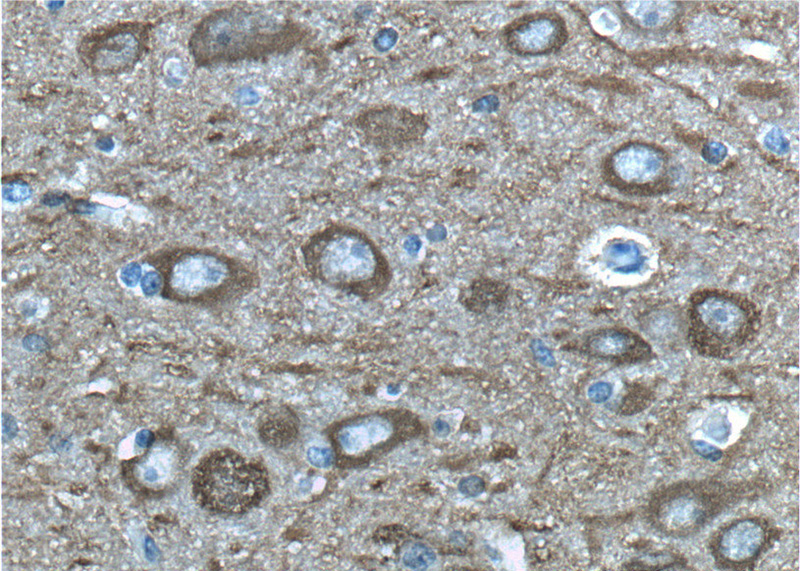 Immunohistochemistry of paraffin-embedded human brain tissue slide using Catalog No:113287(ENO2 Antibody) at dilution of 1:200 (under 40x lens)