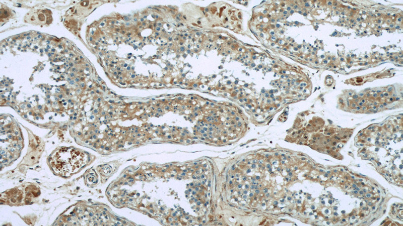 Immunohistochemical of paraffin-embedded human testis using Catalog No:107464(PRDX2 antibody) at dilution of 1:50 (under 10x lens)