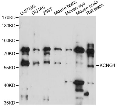 Western blot - KCNG4 Polyclonal Antibody 