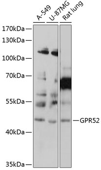 Western blot - GPR52 Polyclonal Antibody 