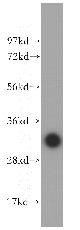 human heart tissue were subjected to SDS PAGE followed by western blot with Catalog No:112371(MAEA antibody) at dilution of 1:400