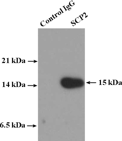 IP Result of anti-SCP2 (IP:Catalog No:115016, 4ug; Detection:Catalog No:115016 1:500) with HepG2 cells lysate 3600ug.