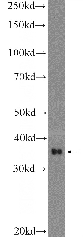 mouse brain tissue were subjected to SDS PAGE followed by western blot with Catalog No:115600(SRR Antibody) at dilution of 1:1000