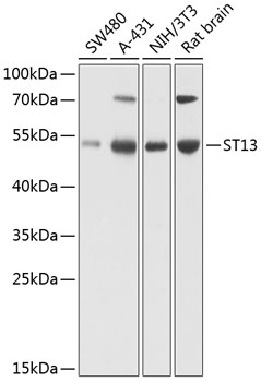 Western blot - ST13 Polyclonal Antibody 