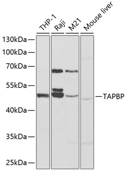 Western blot - TAPBP Polyclonal Antibody 