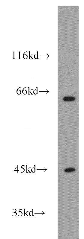 mouse skeletal muscle tissue were subjected to SDS PAGE followed by western blot with Catalog No:110935(GEFT-Specific antibody) at dilution of 1:1500