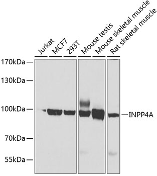 Western blot - INPP4A Polyclonal Antibody 