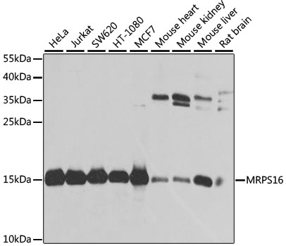 Western blot - MRPS16 Polyclonal Antibody 