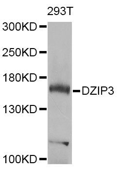 Western blot - DZIP3 Polyclonal Antibody 