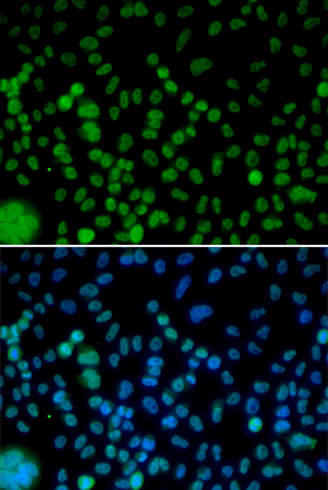 Immunofluorescence - IRF2 Polyclonal Antibody 