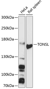 Western blot - TONSL Polyclonal Antibody 