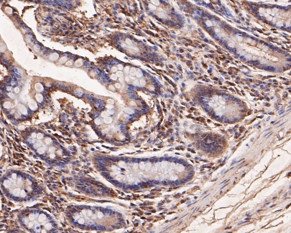 Fig9: Immunohistochemical analysis of paraffin-embedded human small intestine tissue using anti-SPATA5L1 antibody. The section was pre-treated using heat mediated antigen retrieval with Tris-EDTA buffer (pH 8.0-8.4) for 20 minutes.The tissues were blocked