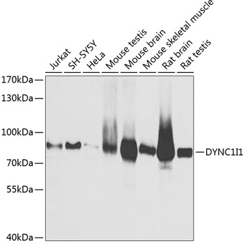 Western blot - DYNC1I1 Polyclonal Antibody 