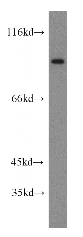 PC-3 cells were subjected to SDS PAGE followed by western blot with Catalog No:115164(SGEF antibody) at dilution of 1:300