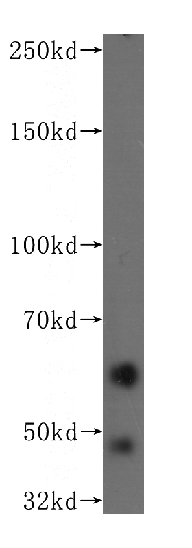 human brain tissue were subjected to SDS PAGE followed by western blot with Catalog No:107342(NUMB antibody) at dilution of 1:300